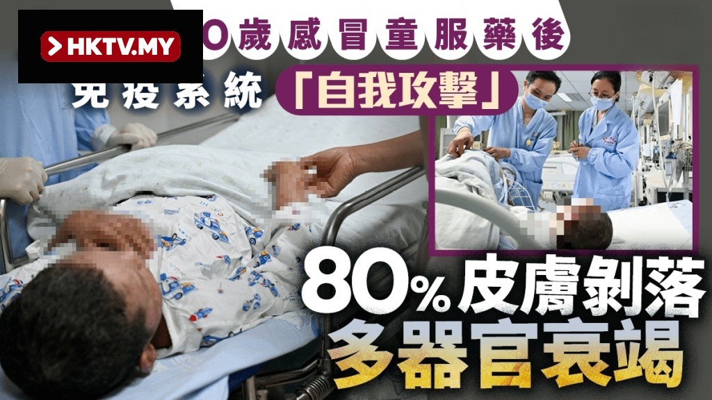 10-Year-Old Child in Hubei Develops 80% Skin Erosion After Taking Medicine for Cold